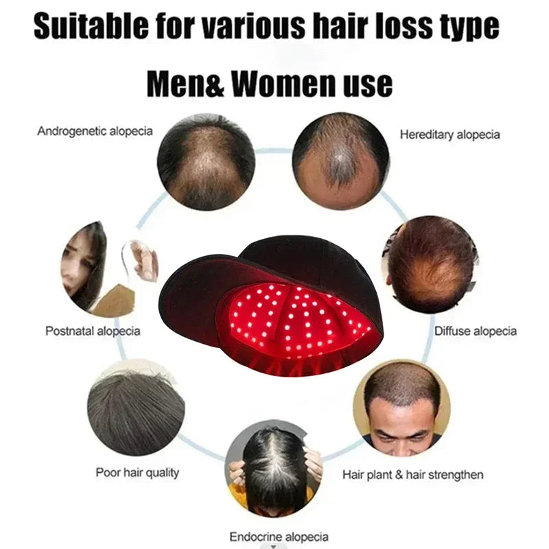 Red Light Hair Therapy Hat